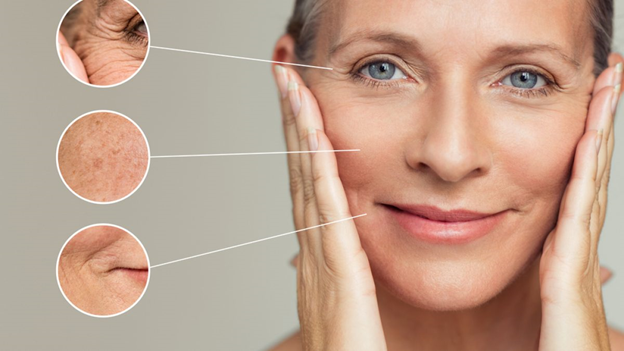 Sculptra Visual Aid
