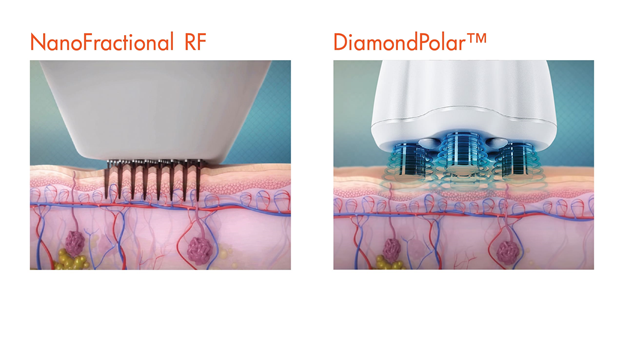 RF SmartScan Visual Aid 2