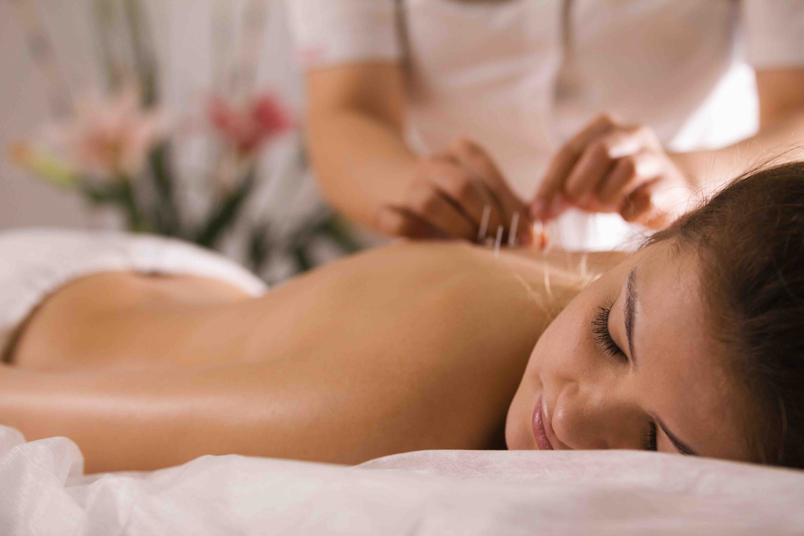 Acupuncture treatment